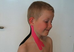 Kinesio Tape on a childs neck