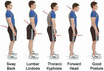 5 posture forms